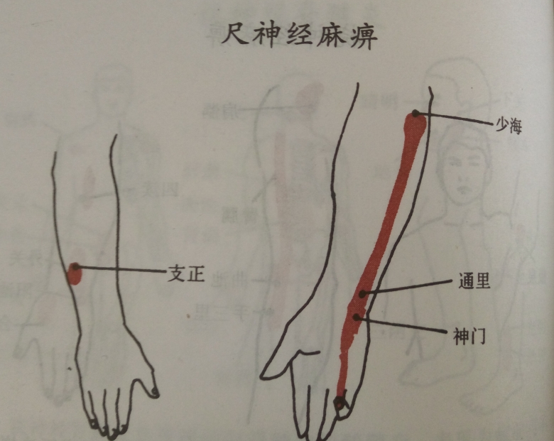 特色灸疗和无痛六合针灸技术公开课在北京举办