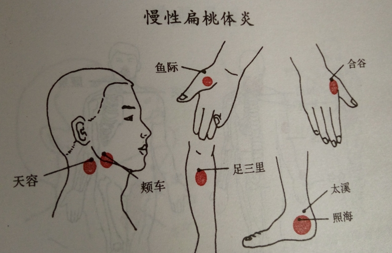 特色灸疗和无痛六合针灸技术公开课在北京举办