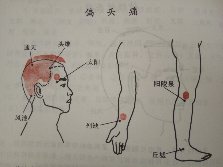 特色灸疗和无痛六合针灸技术公开课在北京举办