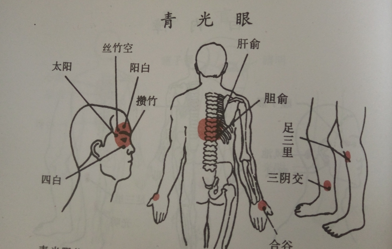 青光眼针灸疗法